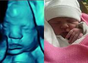 A reliable studio for 3D 4D baby ultrasound