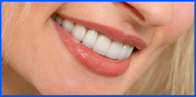 Safe Treatment of Porcelain Veneers in Melbourne