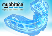 Best Myobrace Treatment Melbourne