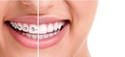 Top Orthodontics Treatment in Melbourne - Richmond Family Dental