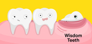 BEDC - Wisdom Teeth