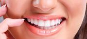 Best teeth whitening - BEDC (03 95788500)