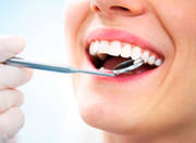 Get Perfect Smile with Dental Implants in Bundoora - Sunrise Dental